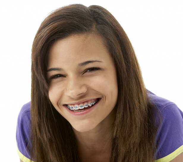 Dental Braces McAllen Orthodontics Braces and Invisalign